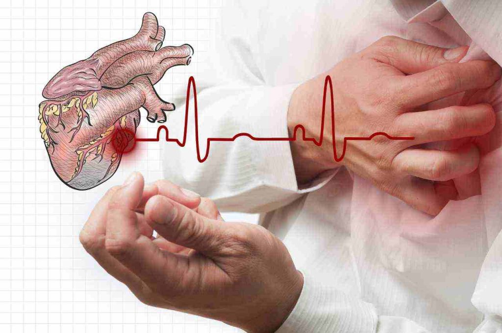 riconoscere i sintomi di un attacco cardiaco